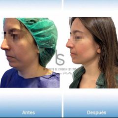 Lipopapada - Dr. José María Serra Mestre