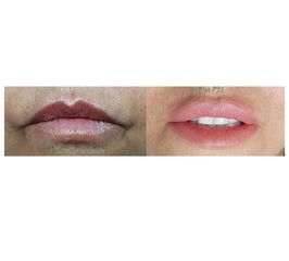 Antes y despues de micropigmentacion
