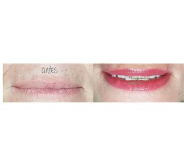 Antes y despues de micropigmentacion