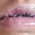 Me operé ayer y me quite los biopolímeros de los labios