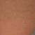 Tratamiento de varices