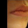 ¿Podría aumentar mis labios aunque tenga otro producto dentro?