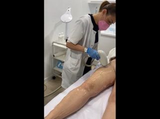 Depilación Láser - Marista Clínica