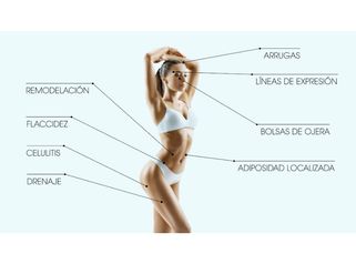 Radiofrecuencia