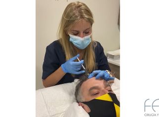 Mesoterapia capilar - Dra. Ángela Hermosa
