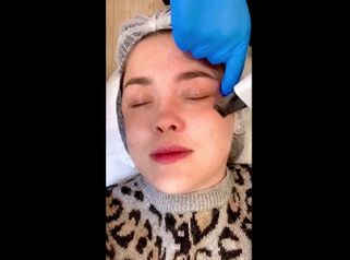 Limpieza facial - Marista Clínica