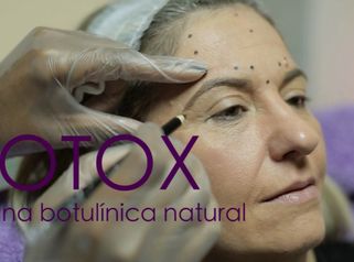 La toxina botulínica, una proteína natural