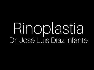 Rinoplastia - Dr. José Luis Díaz Infante