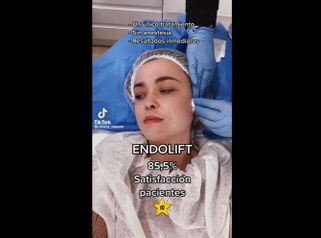 Endolift - Marista Clínica